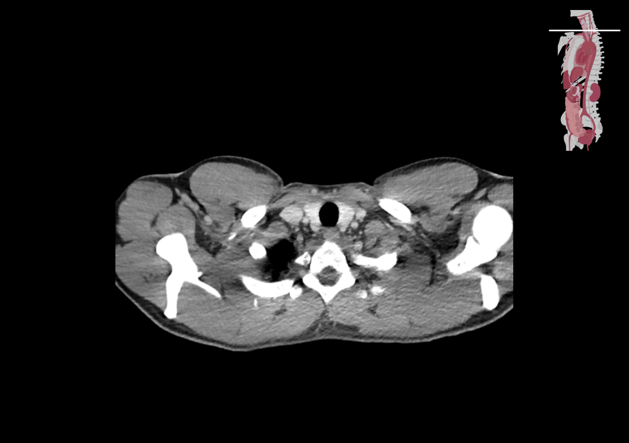 Radiologisch beeld 1