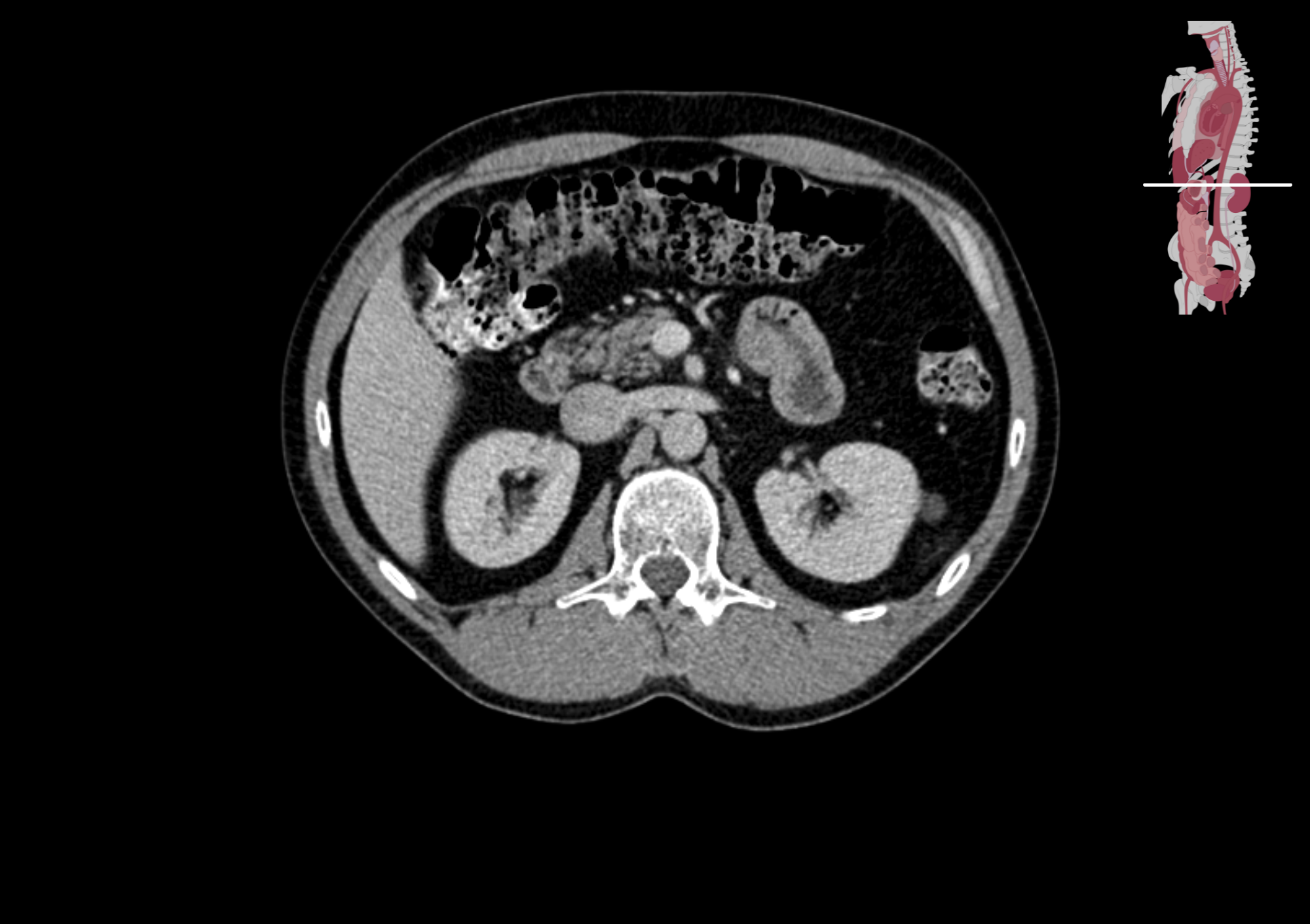 Radiologisch beeld 10