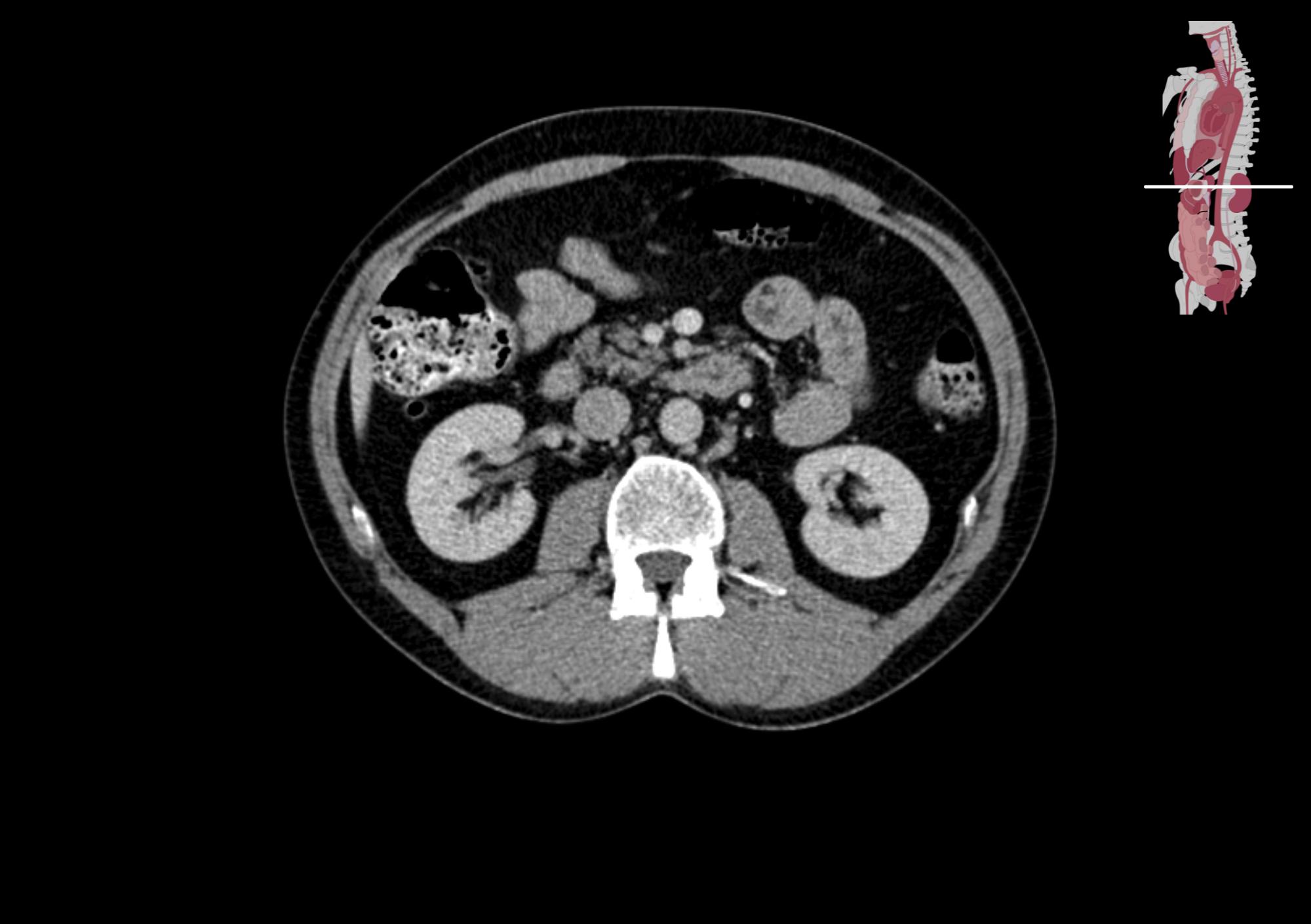 Radiologisch beeld 11