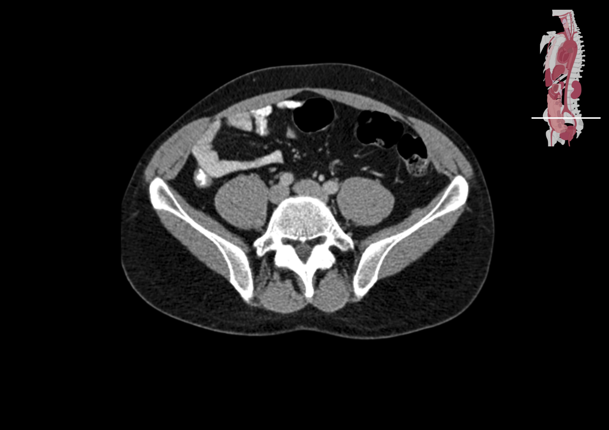 Radiologisch beeld 12