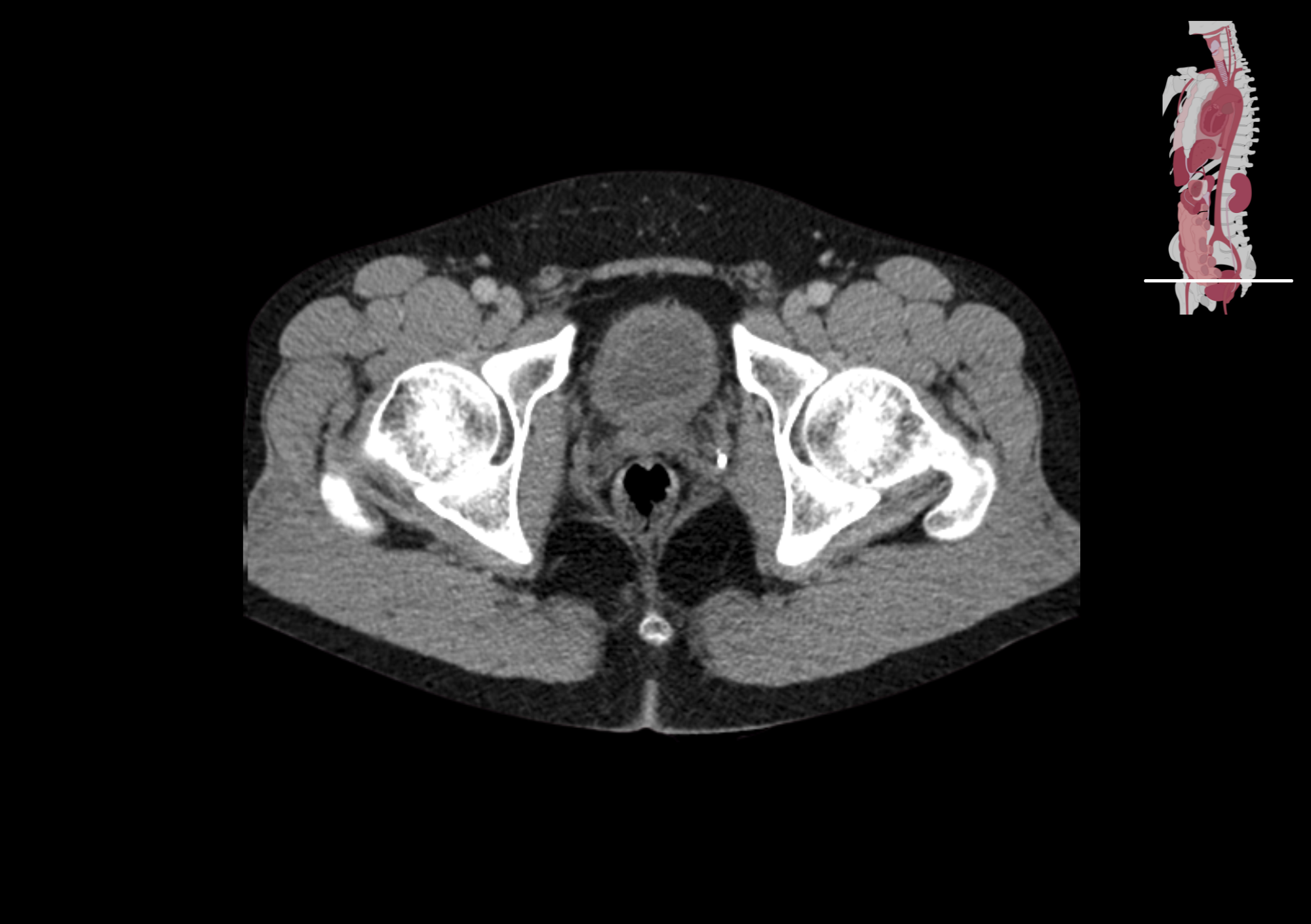 Radiologisch beeld 13