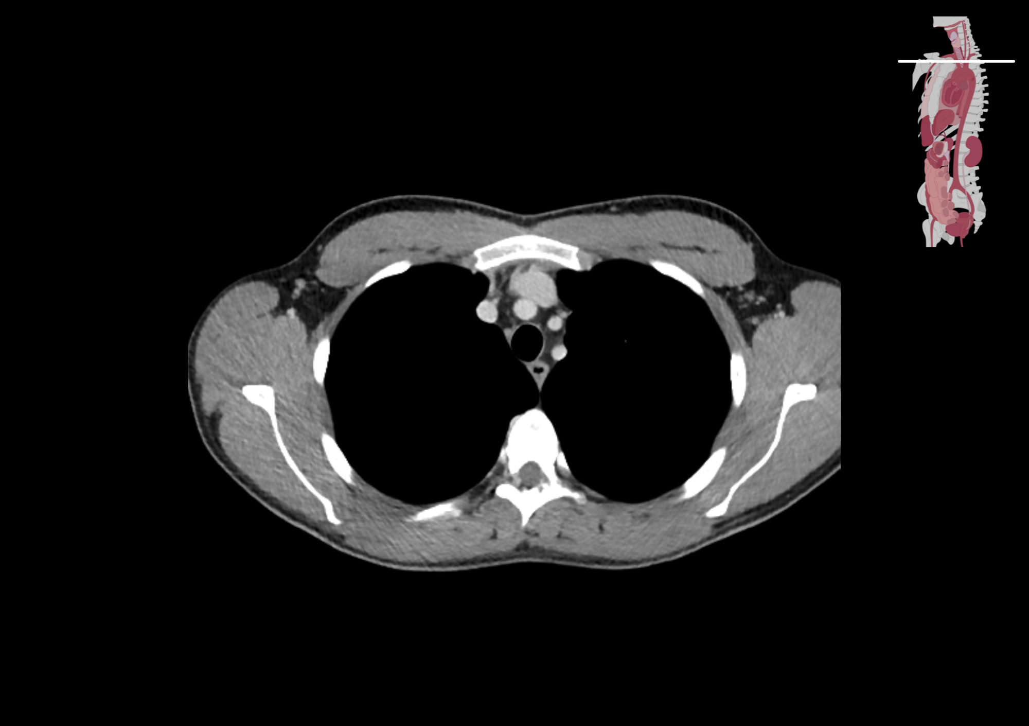 Radiologisch beeld 2