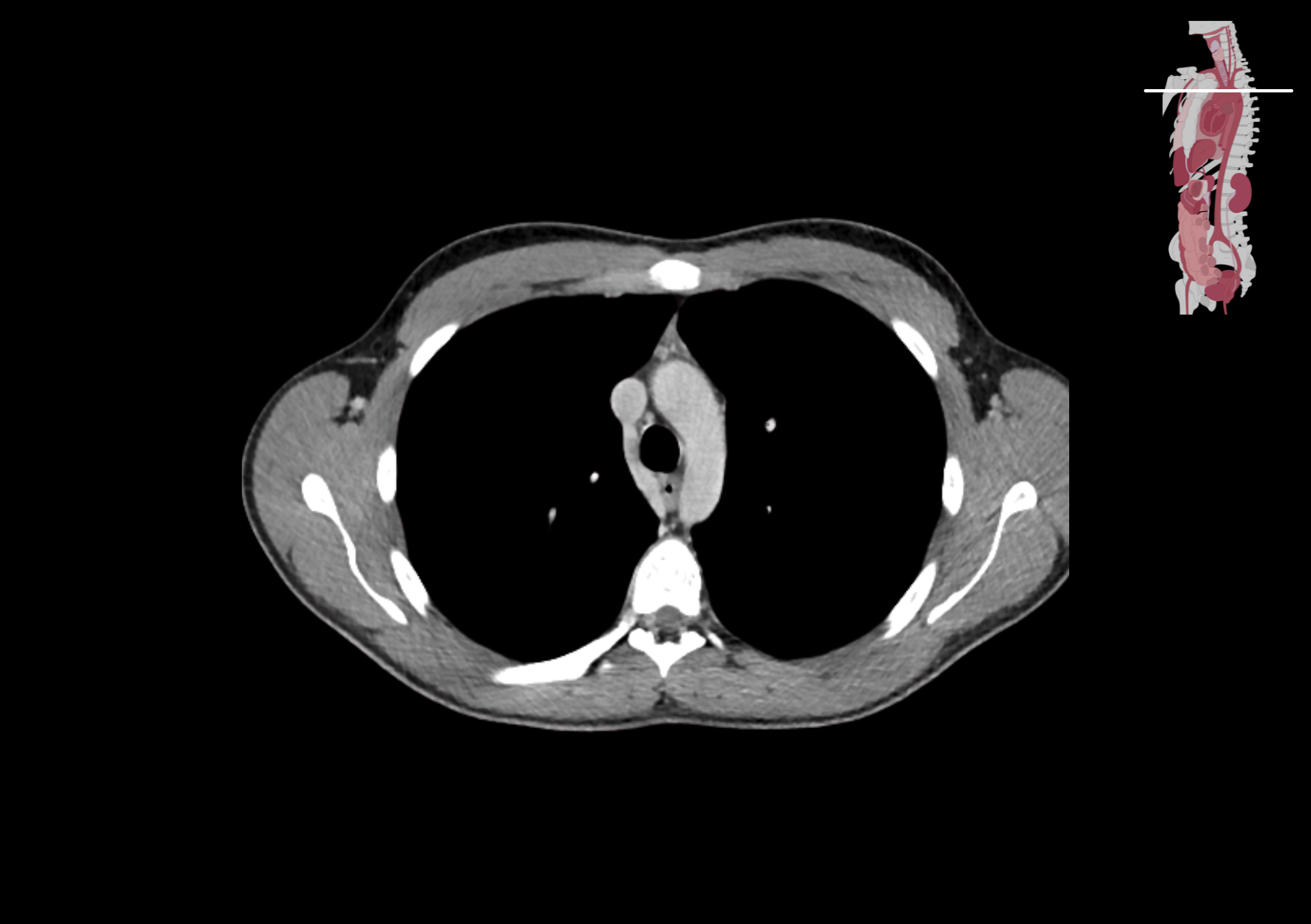 Radiologisch beeld 3