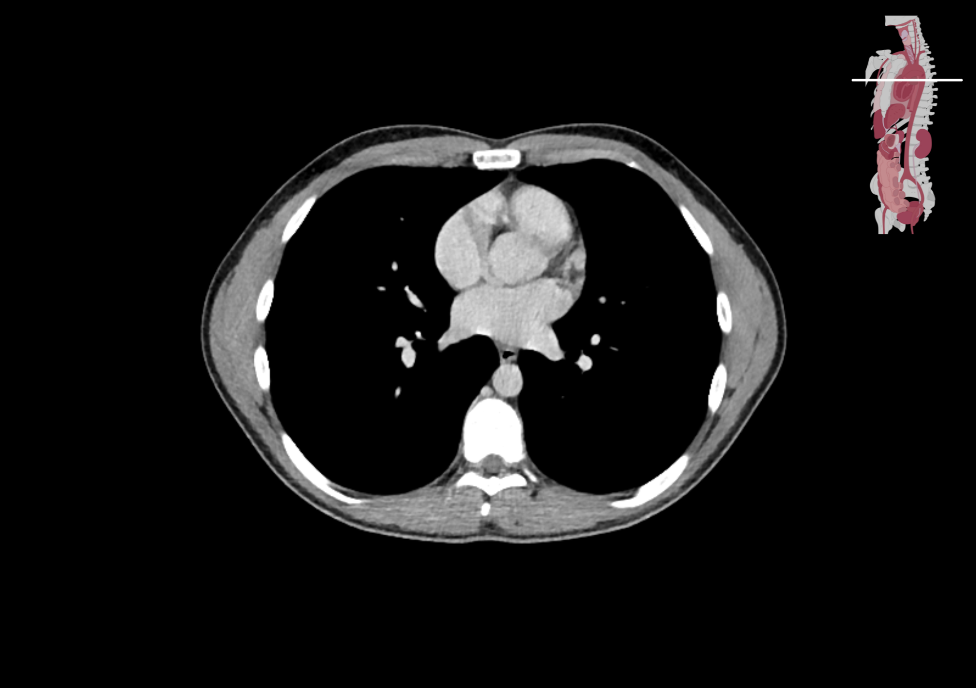Radiologisch beeld 5