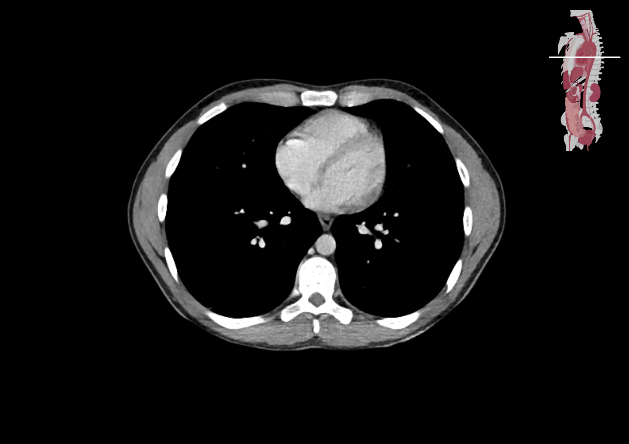 Radiologisch beeld 6
