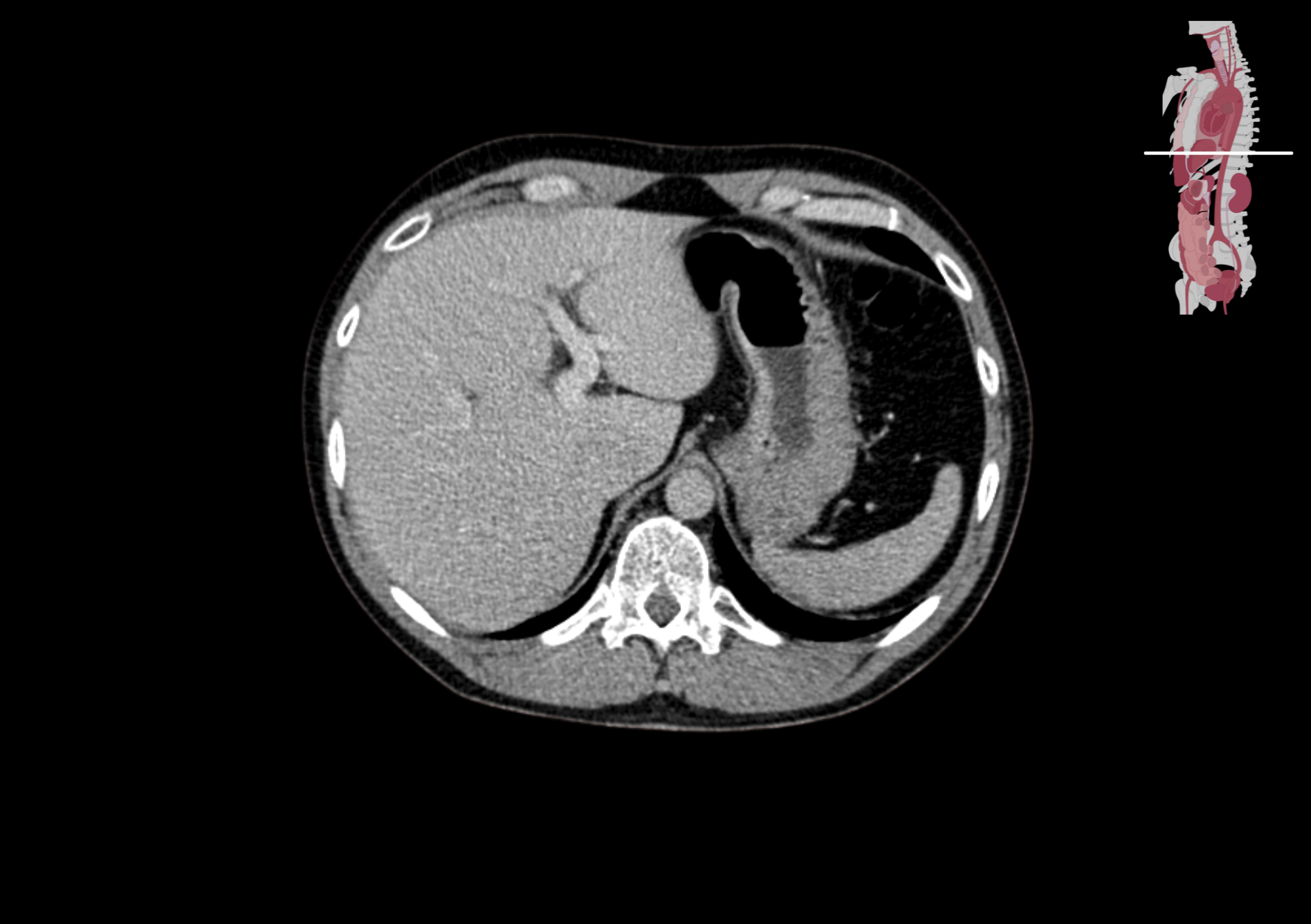 Radiologisch beeld 7