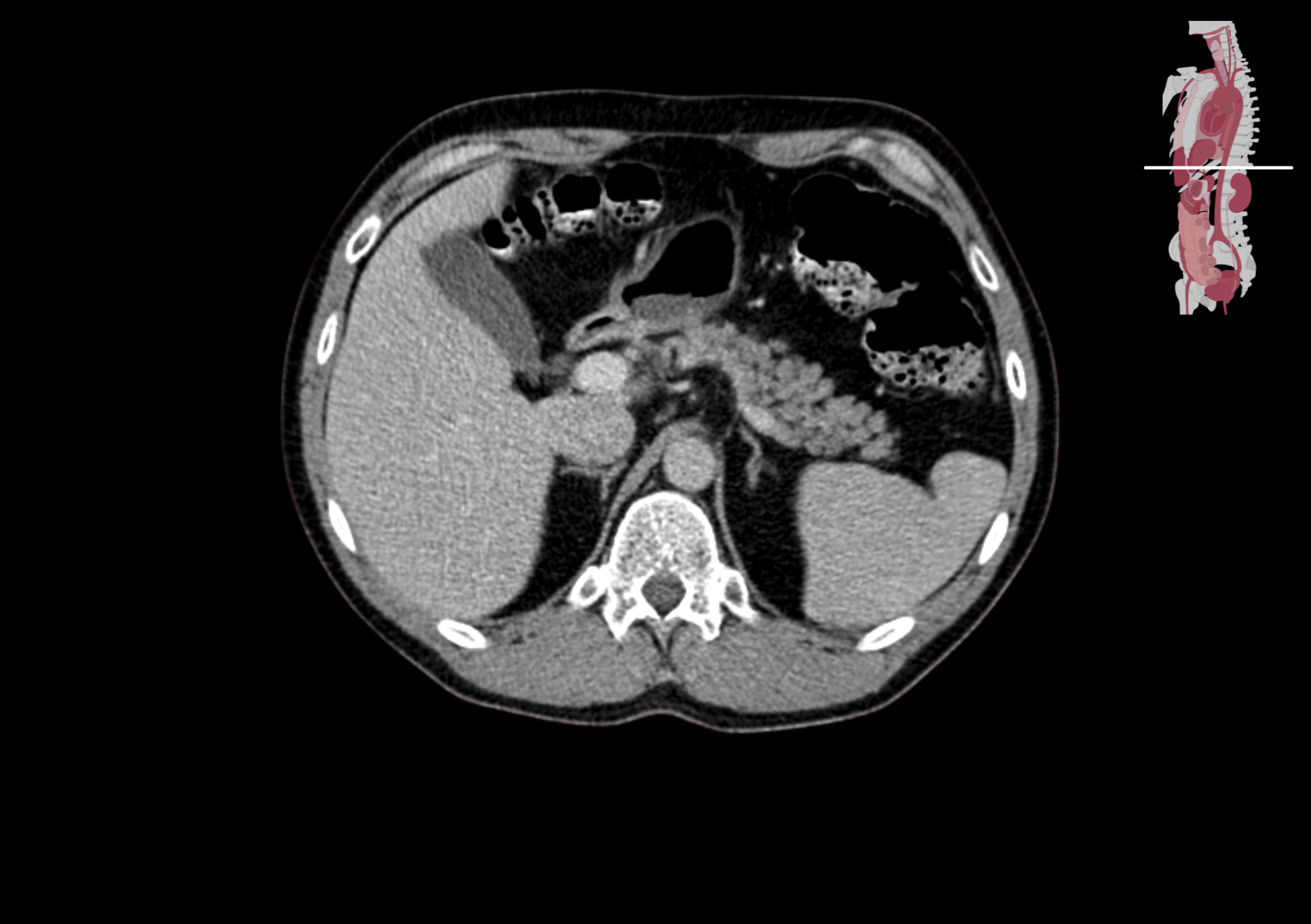 Radiologisch beeld 8