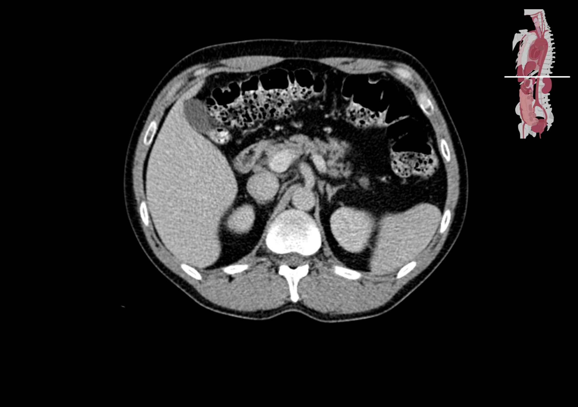 Radiologisch beeld 9